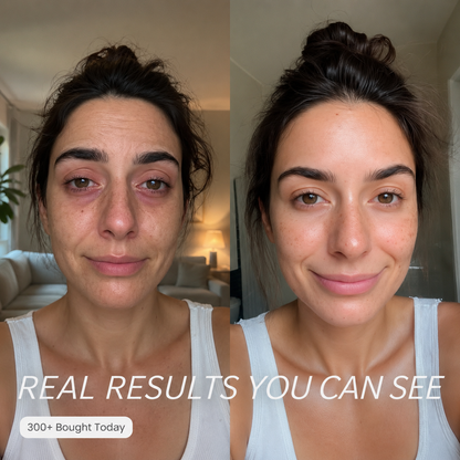 EyeEase – Daily Eye Comfort