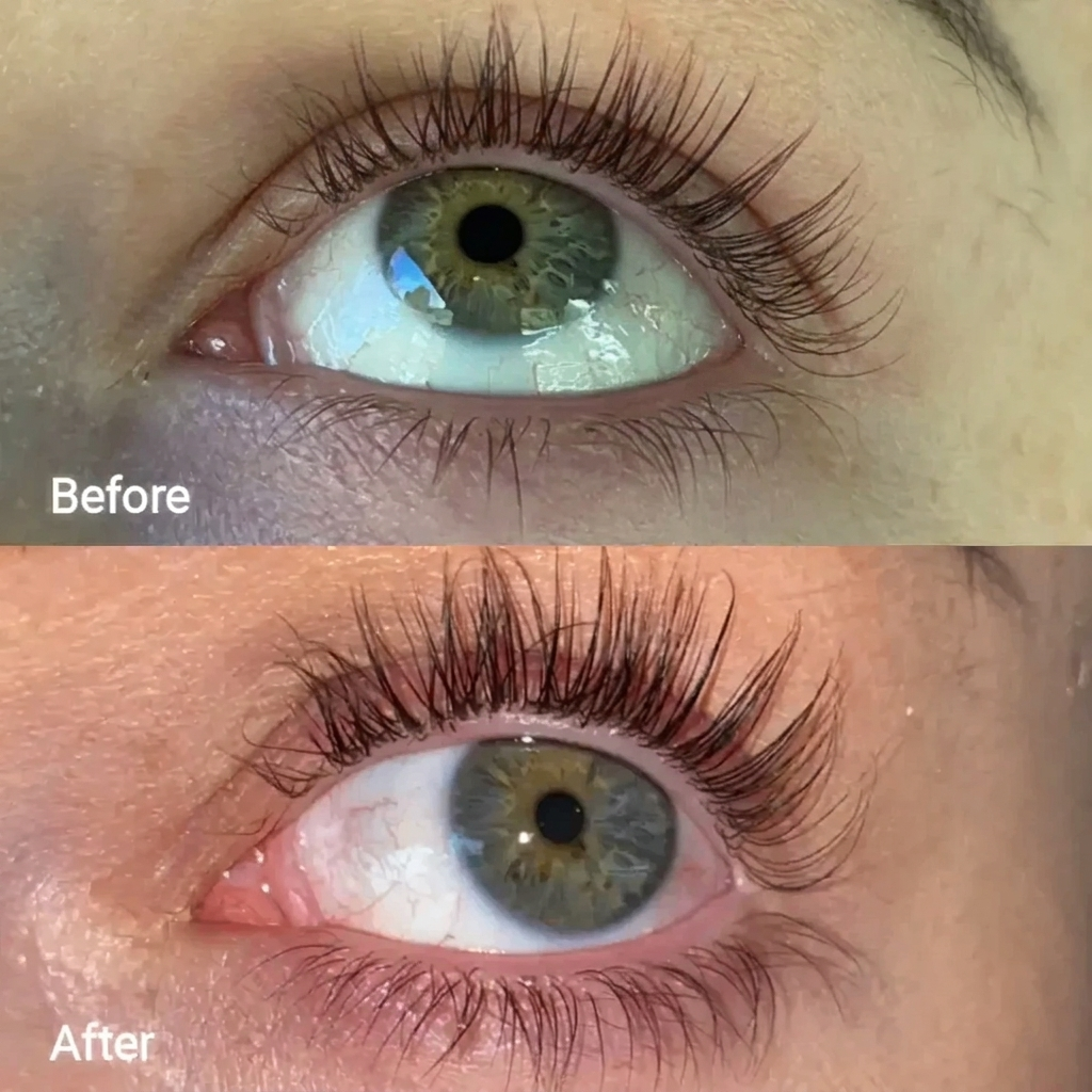 EyeRevive – Heated Eye Wand